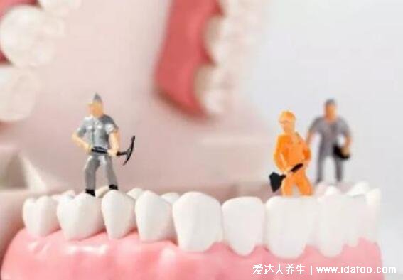 洗牙一次大概多少钱左右，能管多久(一百元可管一年)